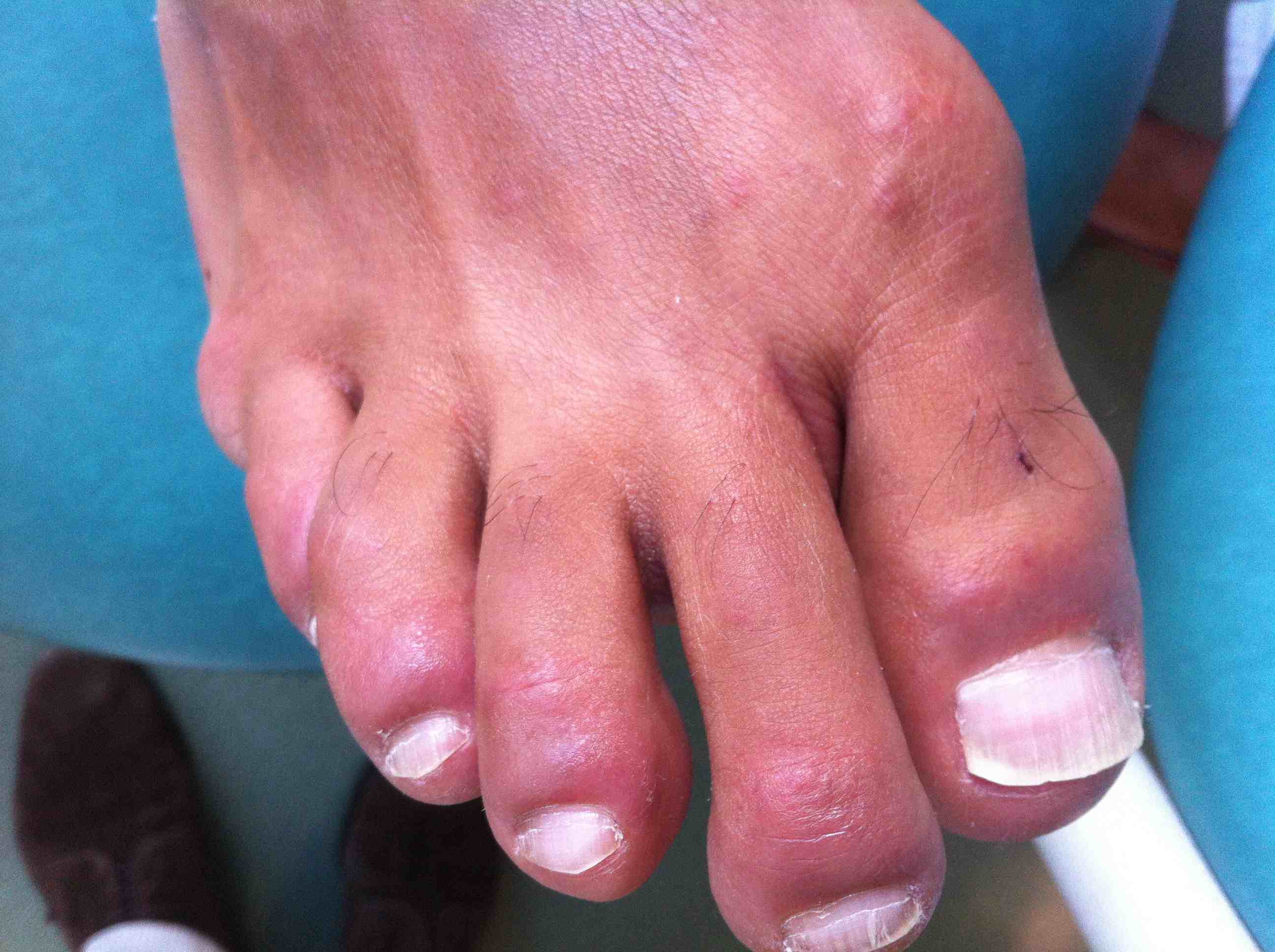 les mains et les pieds les mains et les pieds